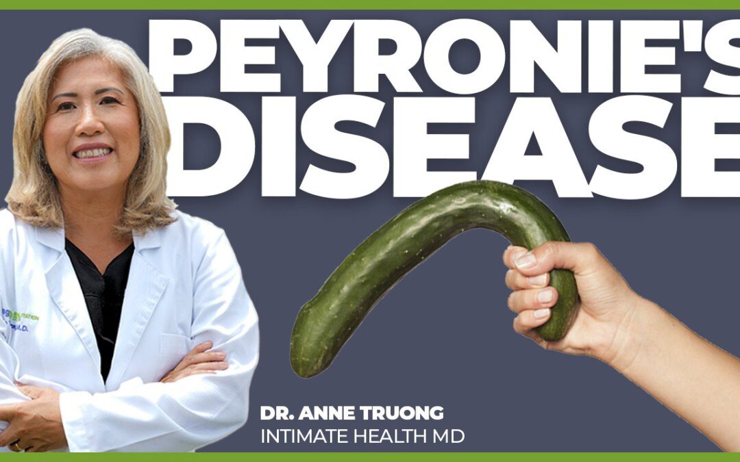 The Truth About Peyronie’s Disease Will Shock You!